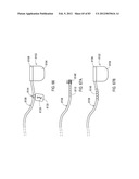 STEERING AN IMPLANTABLE MEDICAL LEAD VIA A ROTATIONAL COUPLING TO A STYLET diagram and image