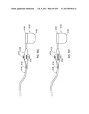 STEERING AN IMPLANTABLE MEDICAL LEAD VIA A ROTATIONAL COUPLING TO A STYLET diagram and image