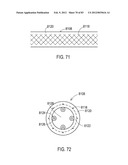 STEERING AN IMPLANTABLE MEDICAL LEAD VIA A ROTATIONAL COUPLING TO A STYLET diagram and image