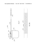 STEERING AN IMPLANTABLE MEDICAL LEAD VIA A ROTATIONAL COUPLING TO A STYLET diagram and image