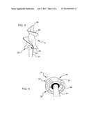 VISCEROTOMY CLOSURE DEVICE AND METHOD OF USE diagram and image