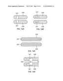 APPARATUS AND METHODS FOR OCCLUDING AN ANATOMICAL STRUCTURE diagram and image