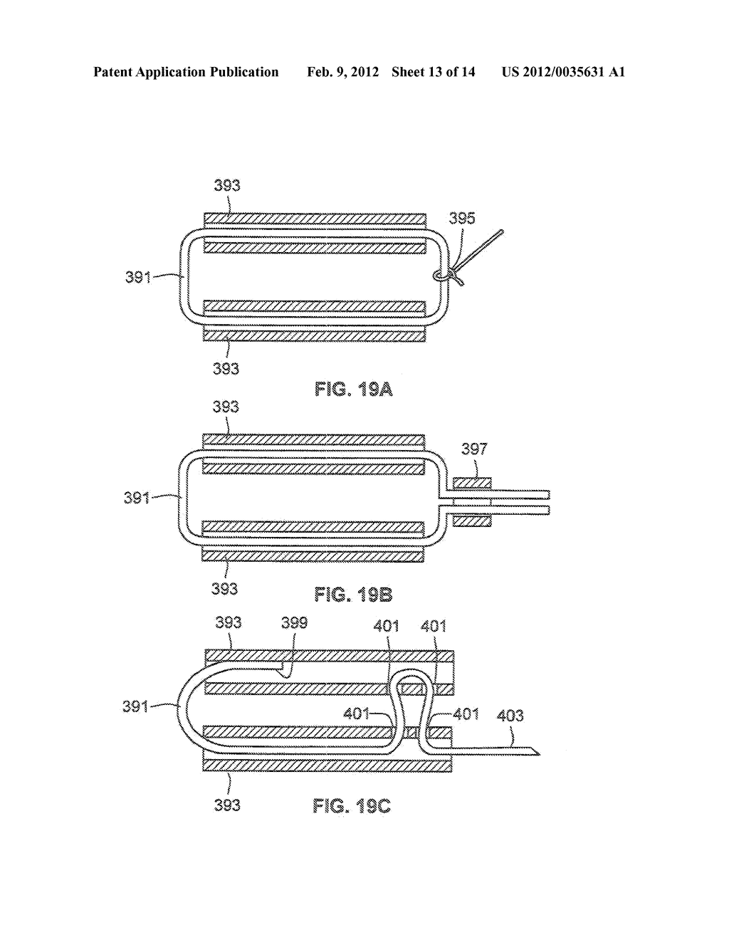 APPARATUS AND METHODS FOR OCCLUDING AN ANATOMICAL STRUCTURE - diagram, schematic, and image 14