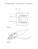 DEVICE FOR CUTTING THE CORNEA OF AN EYE diagram and image