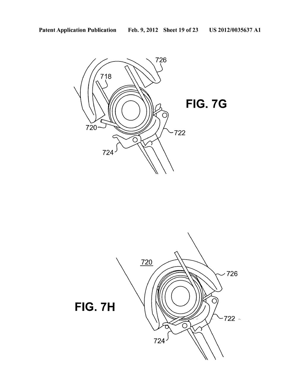 APPARATUSES AND METHODS FOR FORMING INCISIONS IN OCULAR TISSUE - diagram, schematic, and image 20