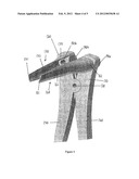 APPARATUS FOR SURGERY diagram and image