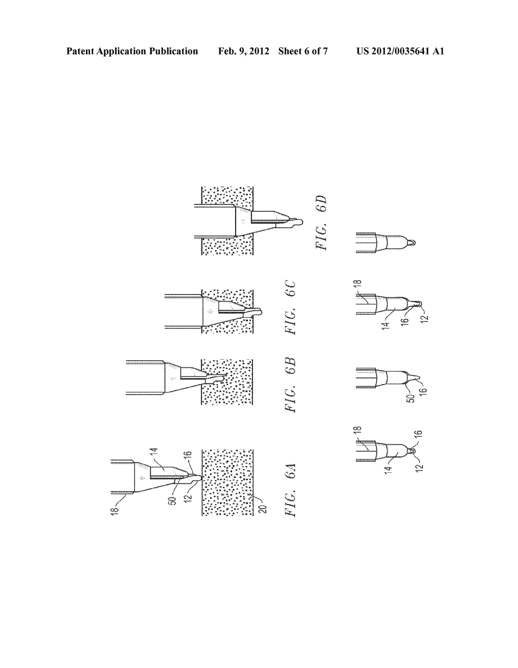 Surgical Obturator - diagram, schematic, and image 07