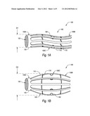 BISTABLE BODY LUMEN FILTER ANCHORS diagram and image