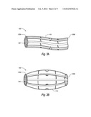 BISTABLE BODY LUMEN FILTER ANCHORS diagram and image