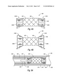 BISTABLE BODY LUMEN FILTER ANCHORS diagram and image