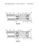 BISTABLE BODY LUMEN FILTER ANCHORS diagram and image