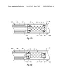 BISTABLE BODY LUMEN FILTER ANCHORS diagram and image