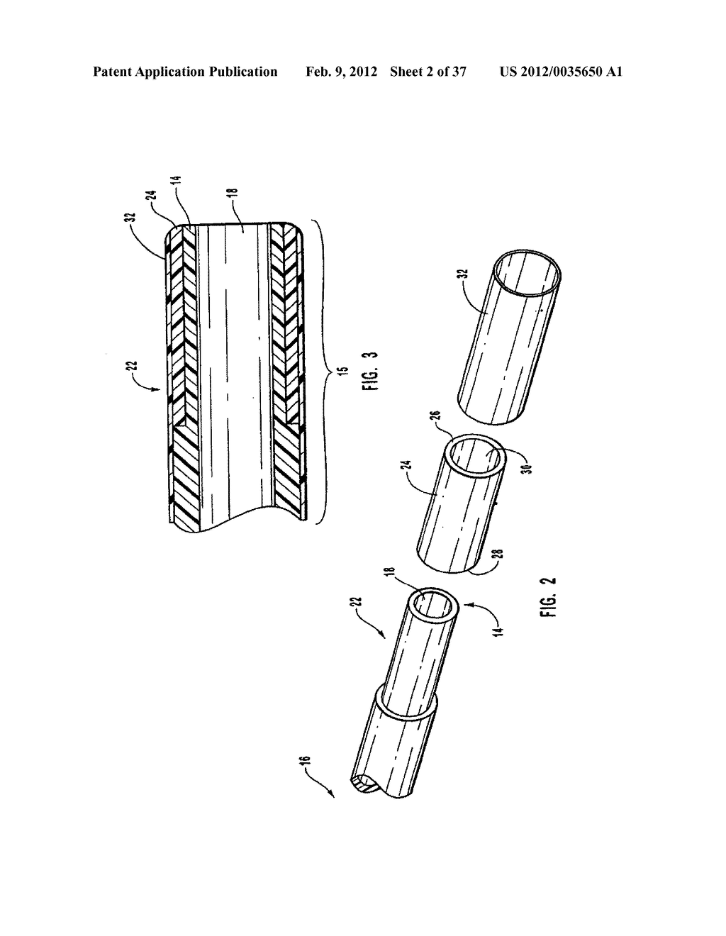 METHODS, SYSTEMS, AND DEVICES FOR DEPLOYING A FILTER FROM A FILTER DEVICE - diagram, schematic, and image 03