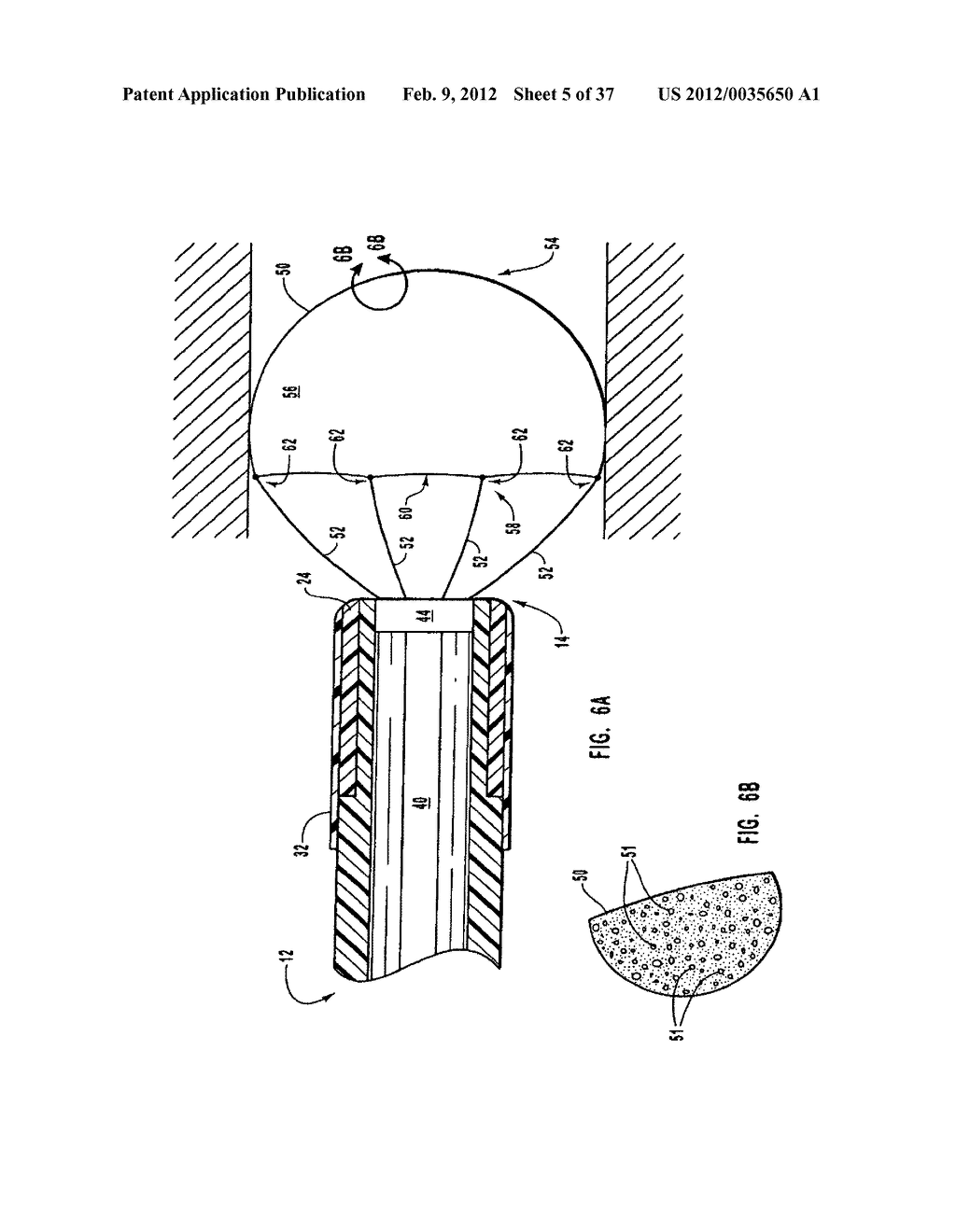 METHODS, SYSTEMS, AND DEVICES FOR DEPLOYING A FILTER FROM A FILTER DEVICE - diagram, schematic, and image 06