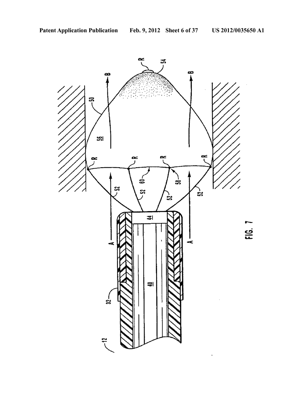 METHODS, SYSTEMS, AND DEVICES FOR DEPLOYING A FILTER FROM A FILTER DEVICE - diagram, schematic, and image 07