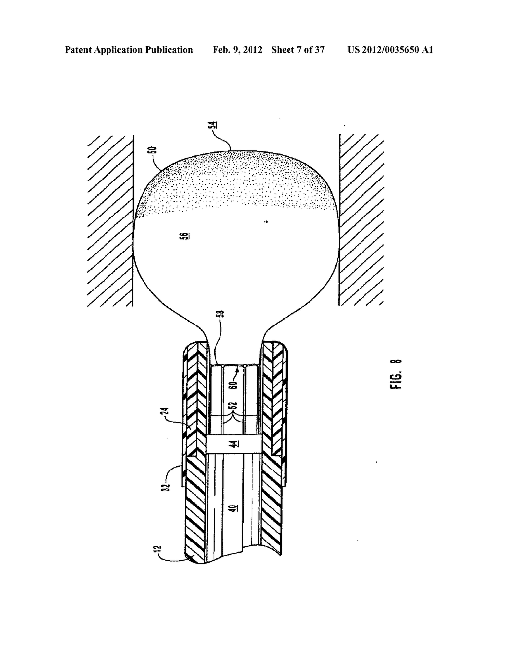 METHODS, SYSTEMS, AND DEVICES FOR DEPLOYING A FILTER FROM A FILTER DEVICE - diagram, schematic, and image 08