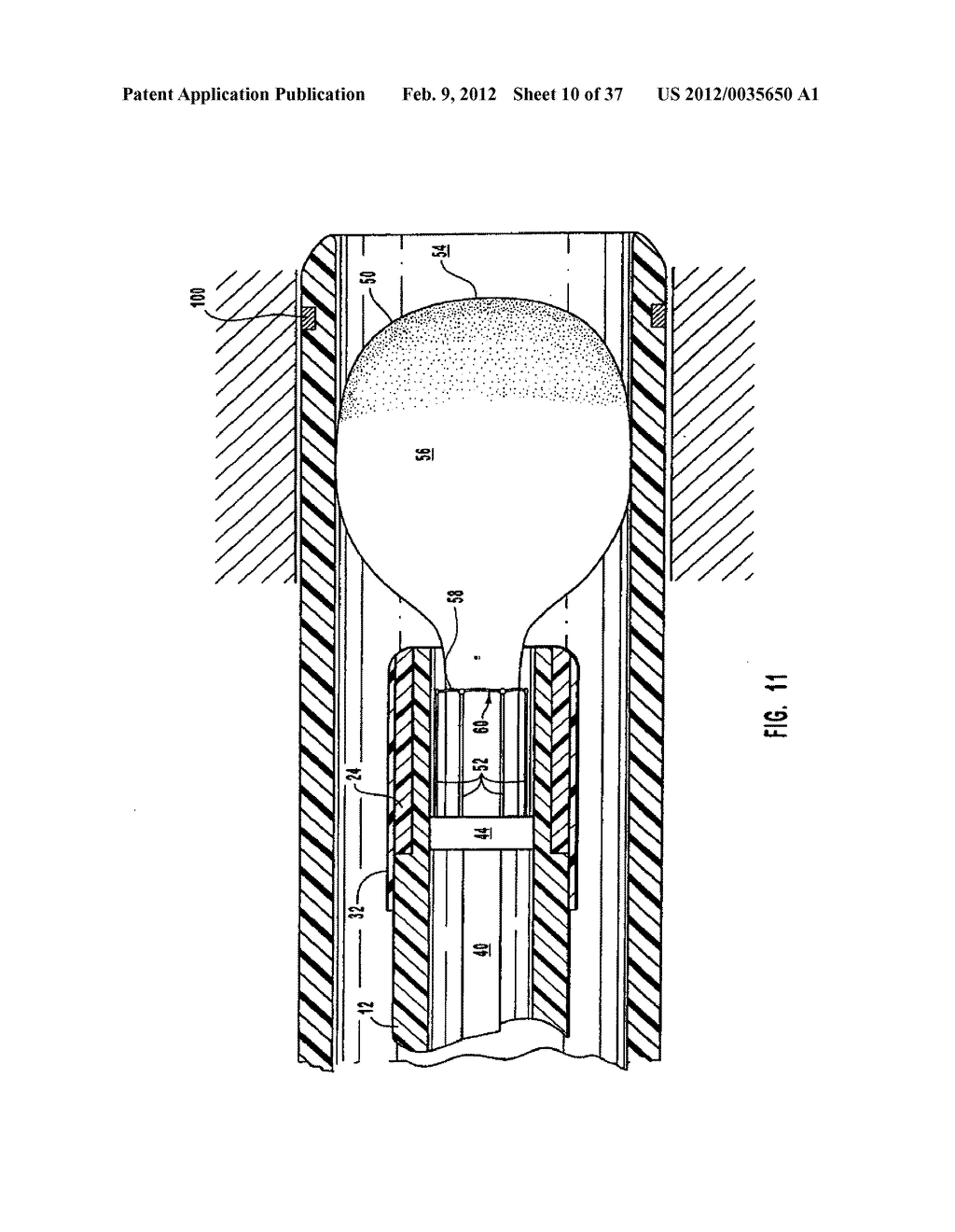 METHODS, SYSTEMS, AND DEVICES FOR DEPLOYING A FILTER FROM A FILTER DEVICE - diagram, schematic, and image 11