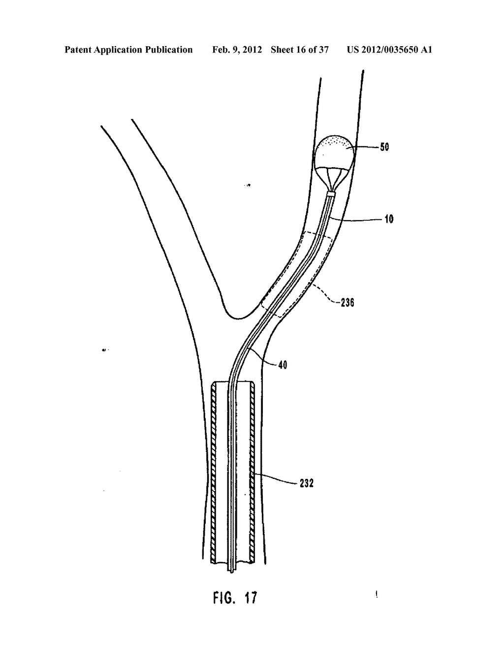 METHODS, SYSTEMS, AND DEVICES FOR DEPLOYING A FILTER FROM A FILTER DEVICE - diagram, schematic, and image 17