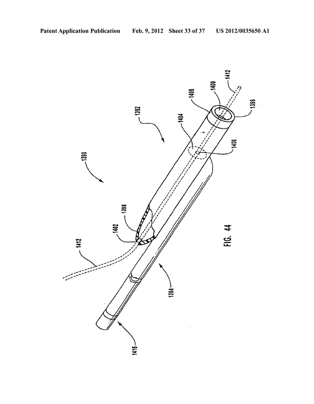 METHODS, SYSTEMS, AND DEVICES FOR DEPLOYING A FILTER FROM A FILTER DEVICE - diagram, schematic, and image 34