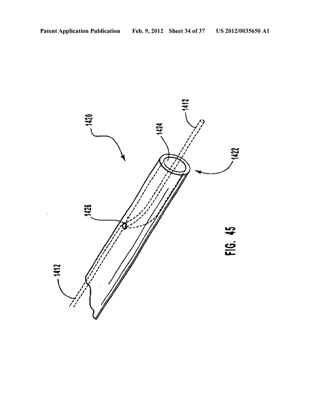 METHODS, SYSTEMS, AND DEVICES FOR DEPLOYING A FILTER FROM A FILTER DEVICE - diagram, schematic, and image 35