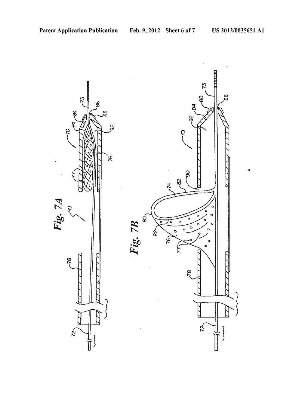 VASCULAR FILTER HAVING ARTICULATION REGION AND METHODS OF USE IN THE     ASCENDING AORTA - diagram, schematic, and image 07