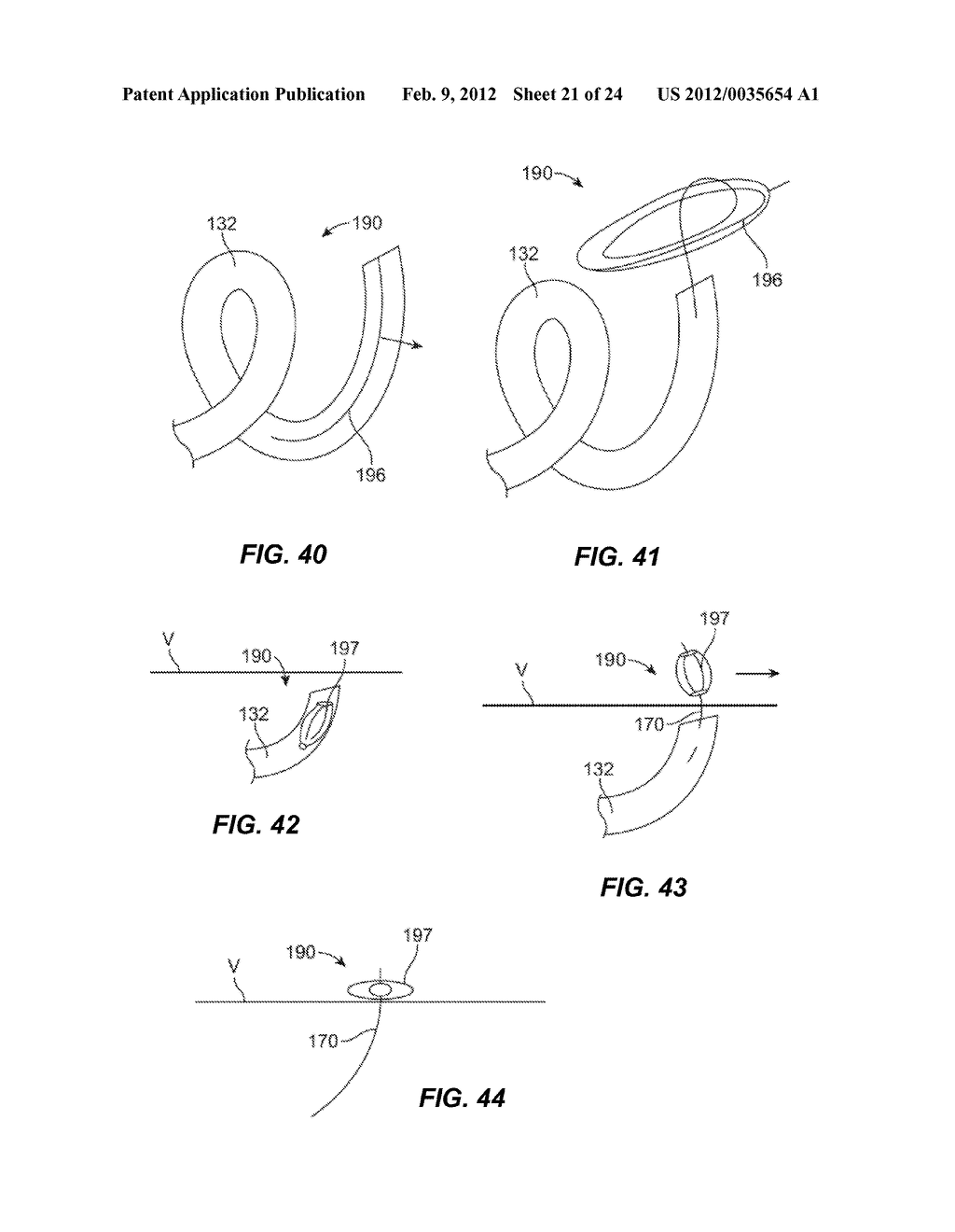 METHODS AND SYSTEMS FOR ADVANCING AND ANCHORING SUTURE IN TISSUE - diagram, schematic, and image 22