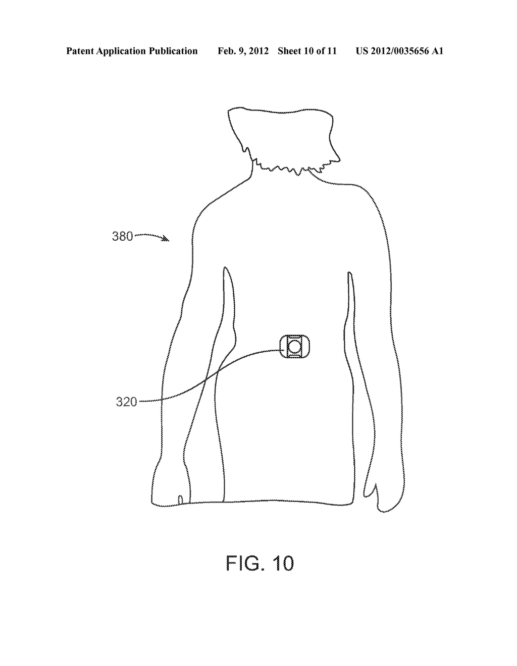 EXTERNAL MAINTENANCE FEATURE FOR MAGNETIC IMPLANT - diagram, schematic, and image 11