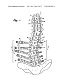 TRANSVERSE CONNECTOR diagram and image