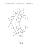 MAINTENANCE FEATURE IN MAGNETIC IMPLANT diagram and image