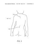 MAINTENANCE FEATURE IN MAGNETIC IMPLANT diagram and image