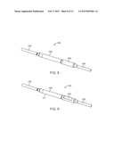 MAINTENANCE FEATURE IN MAGNETIC IMPLANT diagram and image