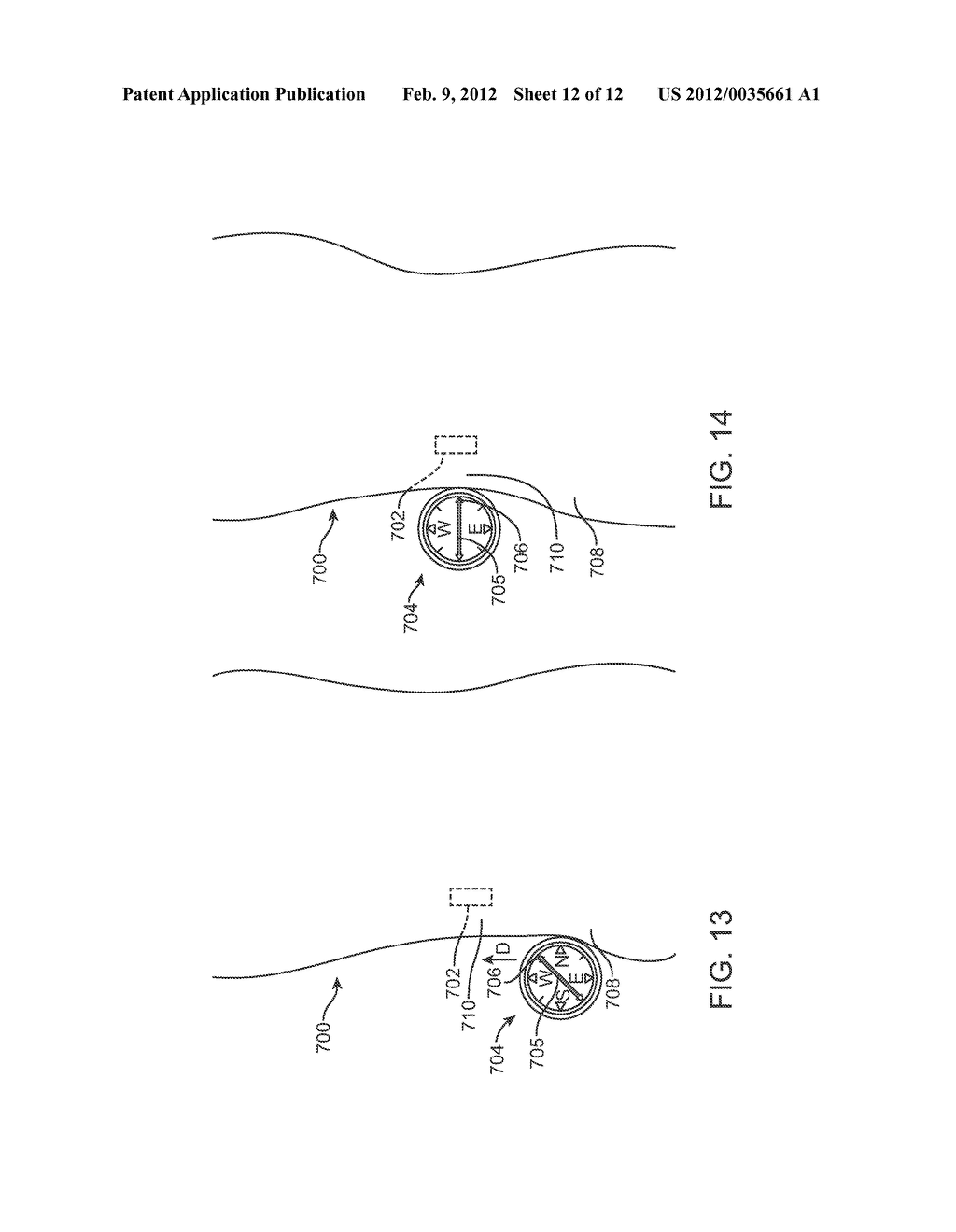 MAINTENANCE FEATURE IN MAGNETIC IMPLANT - diagram, schematic, and image 13