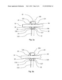 ROD SCREW DYNAMIC IMPLANT FOR STABILIZING A VERTEBRAL COLUMN diagram and image