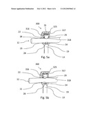 ROD SCREW DYNAMIC IMPLANT FOR STABILIZING A VERTEBRAL COLUMN diagram and image