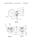 ROD SCREW DYNAMIC IMPLANT FOR STABILIZING A VERTEBRAL COLUMN diagram and image