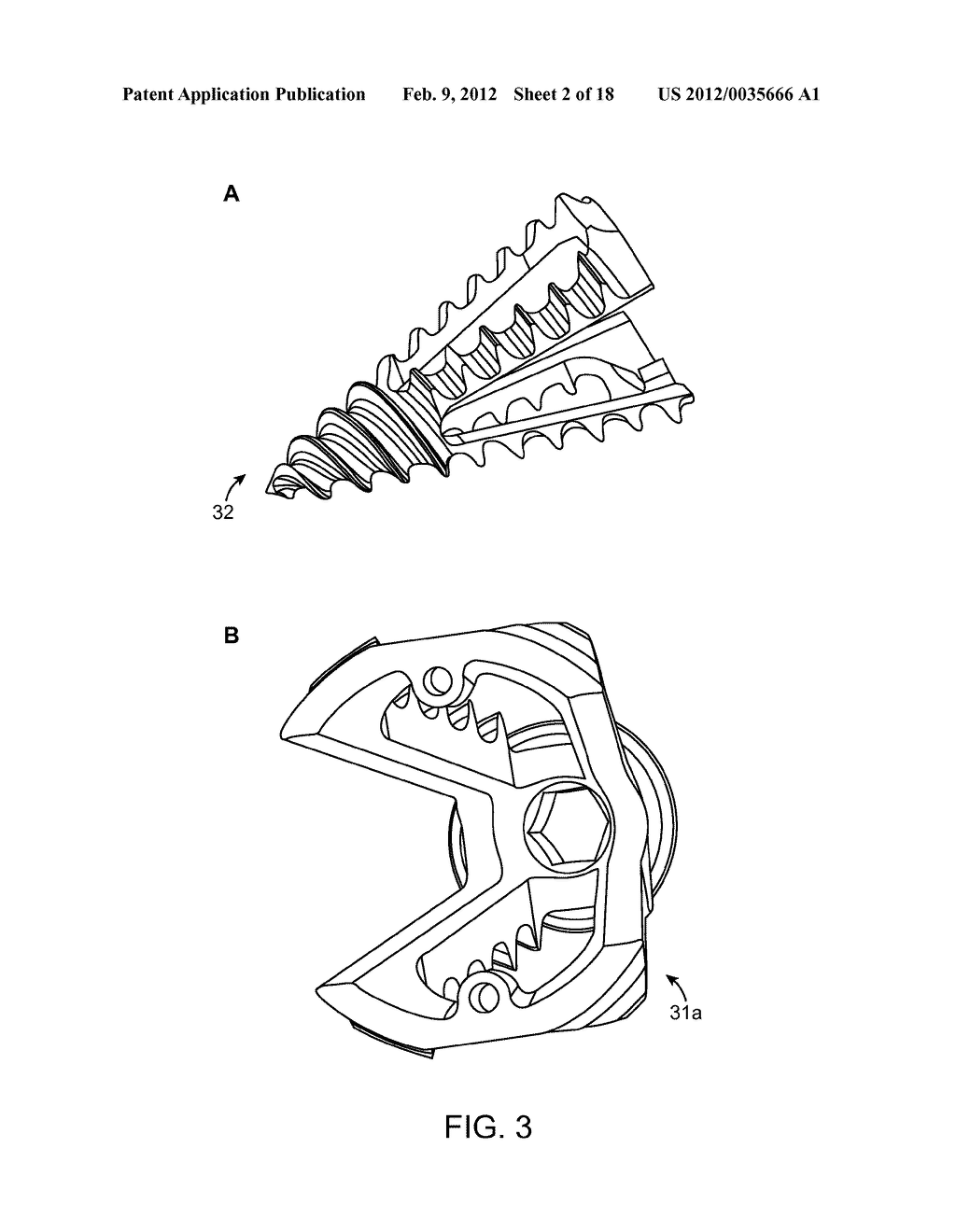 Reduced Bone Fracture Fixation Device - diagram, schematic, and image 03