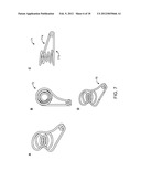 Reduced Bone Fracture Fixation Device diagram and image