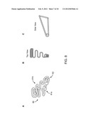 Reduced Bone Fracture Fixation Device diagram and image