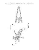 Reduced Bone Fracture Fixation Device diagram and image