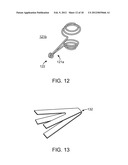 Reduced Bone Fracture Fixation Device diagram and image