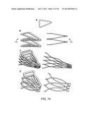 Reduced Bone Fracture Fixation Device diagram and image