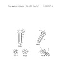 Internal Joint Bracing System and Suture Anchoring Assembly Therefore diagram and image