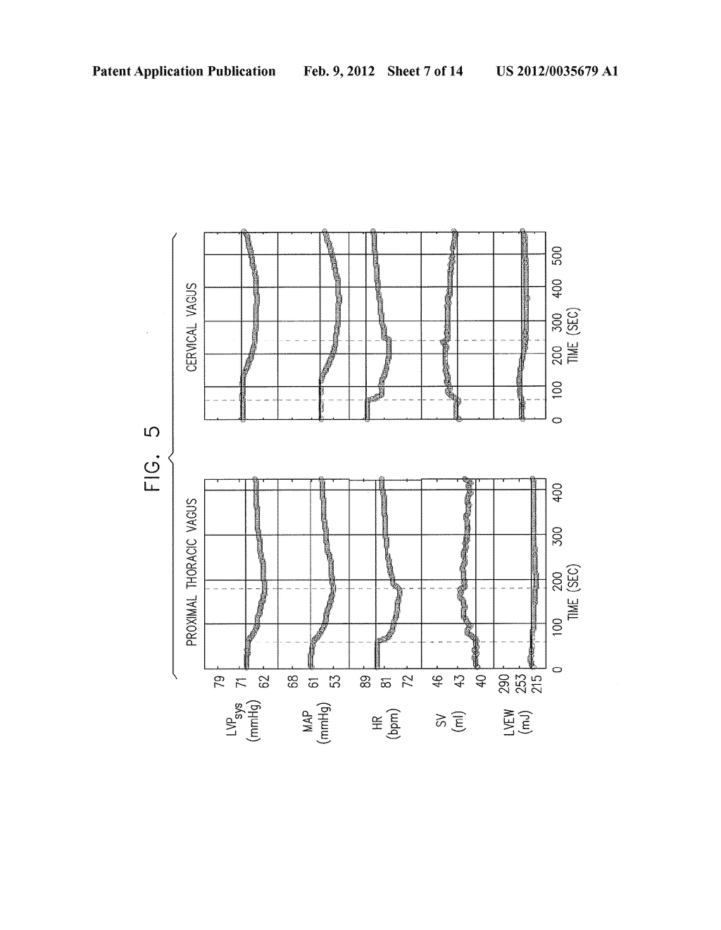 ACUTE MYOCARDIAL INFARCTION TREATMENT BY ELECTRICAL STIMULATION OF THE     THORACIC AORTA - diagram, schematic, and image 08