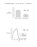 ACUTE MYOCARDIAL INFARCTION TREATMENT BY ELECTRICAL STIMULATION OF THE     THORACIC AORTA diagram and image