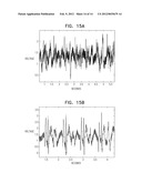 ACUTE MYOCARDIAL INFARCTION TREATMENT BY ELECTRICAL STIMULATION OF THE     THORACIC AORTA diagram and image