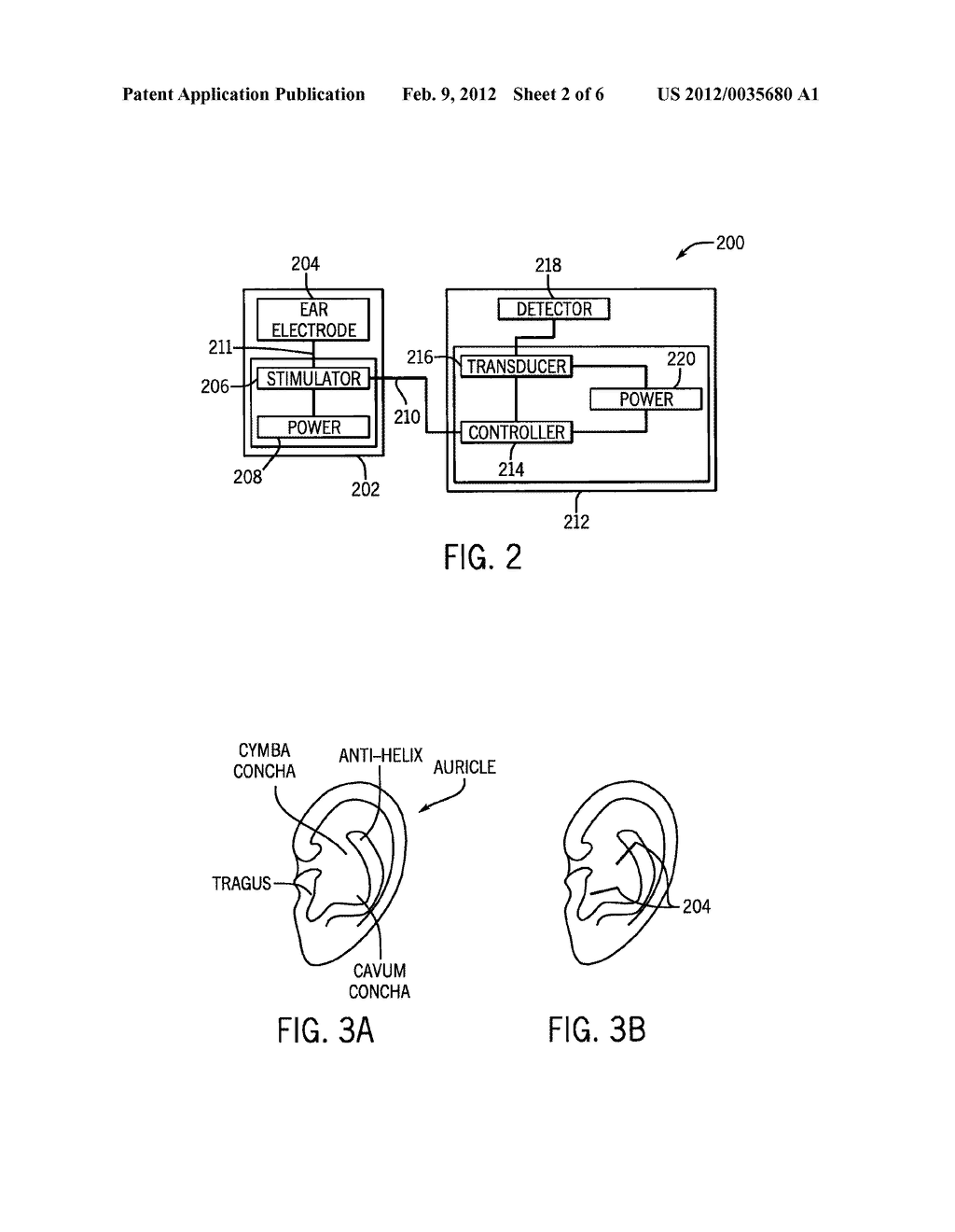 Systems and Methods for Respiratory-Gated Auricular Vagal Afferent Nerve     Stimulation - diagram, schematic, and image 03