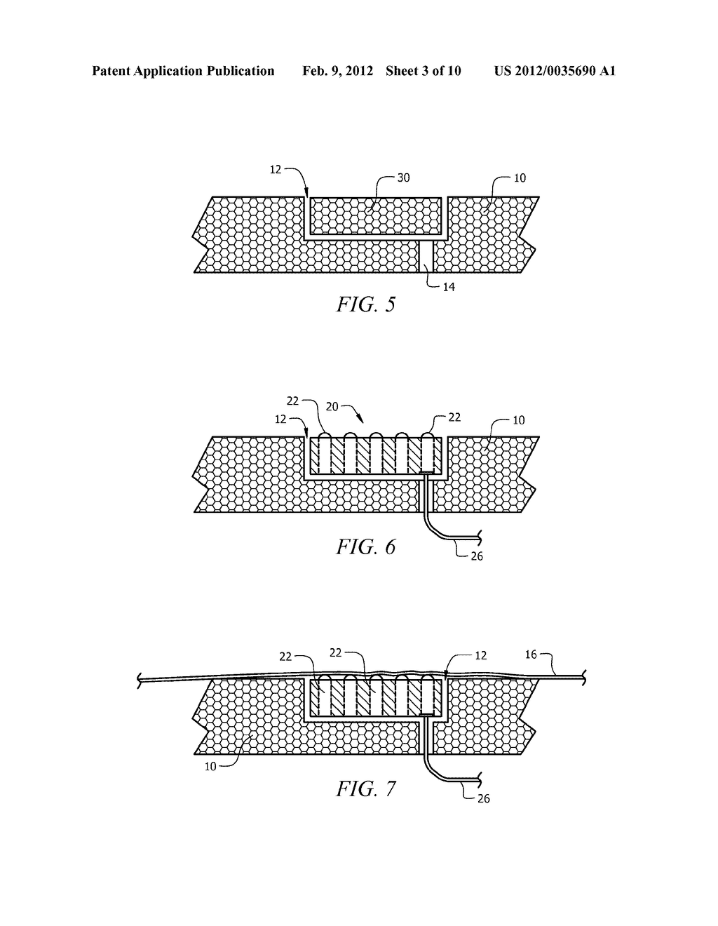 WORN HEAT AND LIGHT-EMITTING DEVICE - diagram, schematic, and image 04