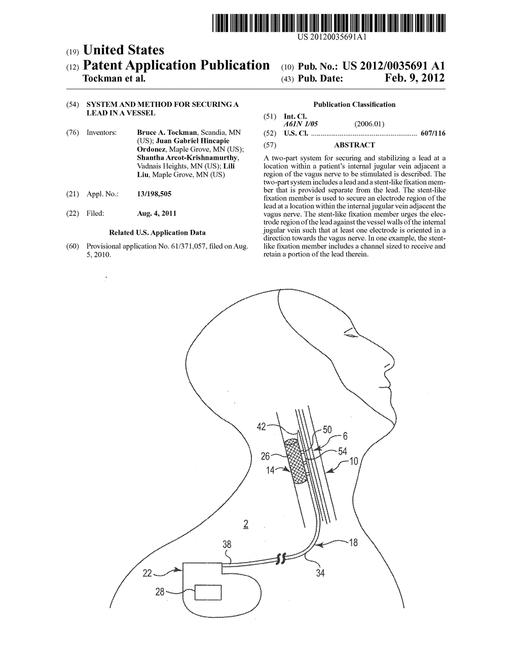 SYSTEM AND METHOD FOR SECURING A LEAD IN A VESSEL - diagram, schematic, and image 01