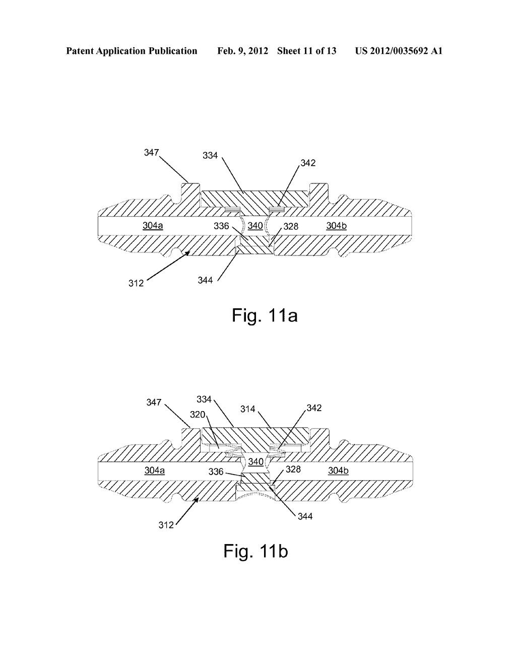 IMPLANTABLE MEDICAL ANCHOR - diagram, schematic, and image 12