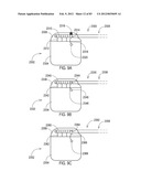 GROUNDING OF A SHIELD WITHIN AN IMPLANTABLE MEDICAL LEAD diagram and image